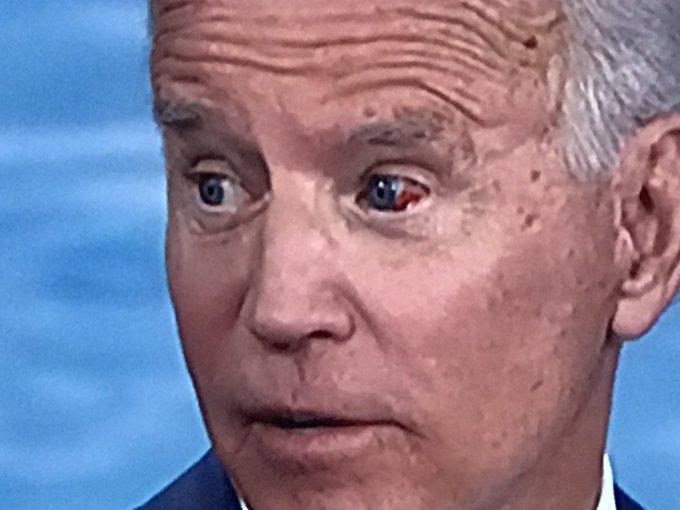 biden eye.jpg